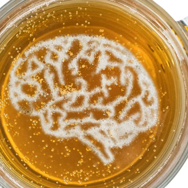 Image for Alcohol related dementia: A silent threat to mental clarity and wellbeing