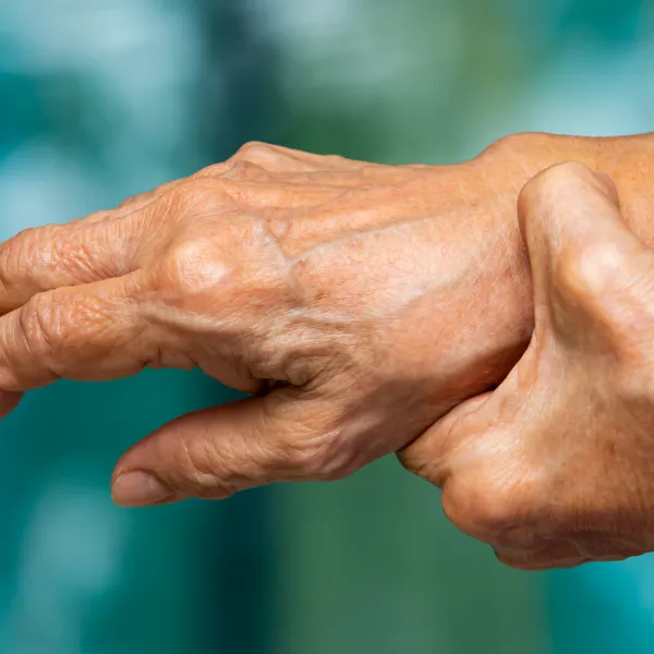 Image for Common types of arthritis explained